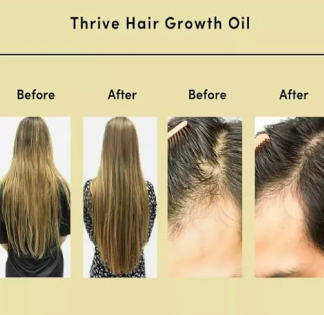 Aceite Esencial Reparador para el Cabello – Hidratación Profunda y Brillo